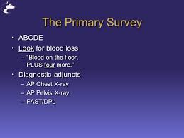 Maybe you would like to learn more about one of these? Introduction To Trauma Erik G Van Eaton Md Assistant Professor Department Of Surgery Division Of Hmc Trauma Univ Of Washington Seattle Washington Erik Ppt Download