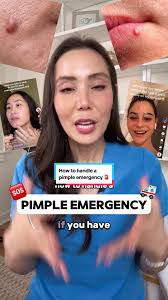 How to Remove Cystic Acne Overnight