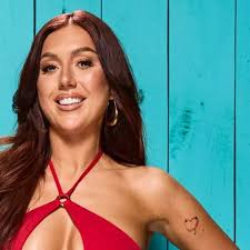 What is Erb's Palsy as Love Islander has villa adapted for her disability