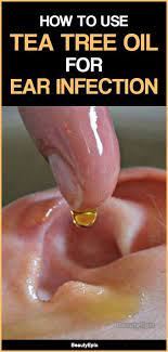How To Use Tea Tree Oil For Ear Infection Natural Cough Remedies Oils For Ear Infection Herbal Cure