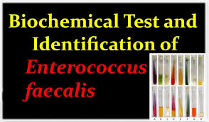 Biochemical Test And Identification Of Enterococcus Faecalis