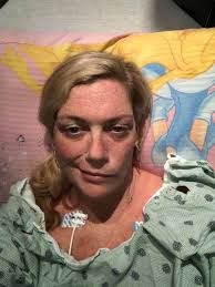 What are normal post-stroke symptoms and how long do they last?