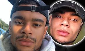 Love Island's Wes Nelson is accused him of lip fillers in pouty selfie