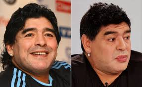 Гарет бэйл и пластика ушей Futbolisty Do I Posle Plasticheskih Operacij