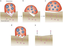 Image result for Bisphosphonates