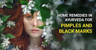 Make a mix of dried bhringaraj ( 5 tsp) in warm water. Ayurvedic Treatment For Pimples And Black Marks Home Remedies