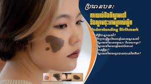 ការព្យាបាលដ៏ចម្លែកមួយ នៅលេិស្នាមដៅលេីមុខពីកំណេីត