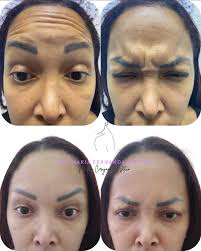 Dra. María Fernanda Arroyo/Advanced Estethic ✨Miami📍