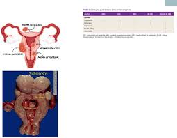 Grátis: patologias benignas do útero - Material Claro e Objetivo em PDF  para Estudo Rápido