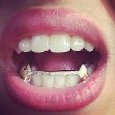 You Can Get This Item For Top Or Bottom Teeth 14k Gold Overlay Any Question You Can Call 718 5237867 12 6 Pm Ny Time Grillz Teeth Gold Teeth Grillz Gold Teeth