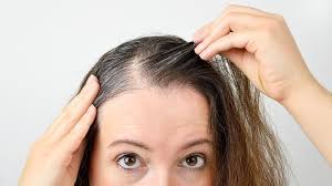 When you are still under 30 yrs of age and there are salt among the pepper in your hair then you are a victim of premature greying. Grey Hair At 25 Here S An Ayurveda Treatment Friday Magazine