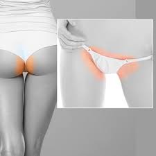 Yet, laser hair removal is still an expensive treatment compared to shaving and waxing. Bikini Full Brazilian Laser Hair Removal Nyc