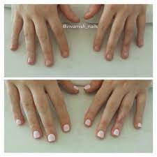 Before And After Nails Were Short Bitten And Brittle After Gel Enhancements They Look And Feel Amazing That Will Simple Nails My Nails White Acrylic Nails
