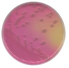 We did not find results for: Oxoid Burkholderia Cepacia Medium