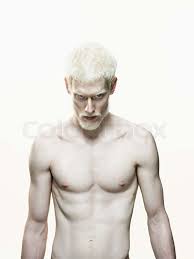 Albino man | Stock image | Colourbox