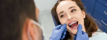 I remove my own braces! Removing Braces How To Remove Braces From Teeth