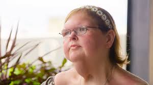 1000-Lb Sisters: All Tammy Slaton's Stunning Weight Loss Pictures After  Skin Removal Surgery