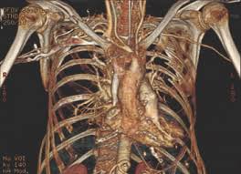 Image result for Chest Trauma