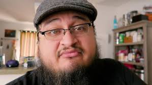 1 Month Post Op- Microdiscectomy