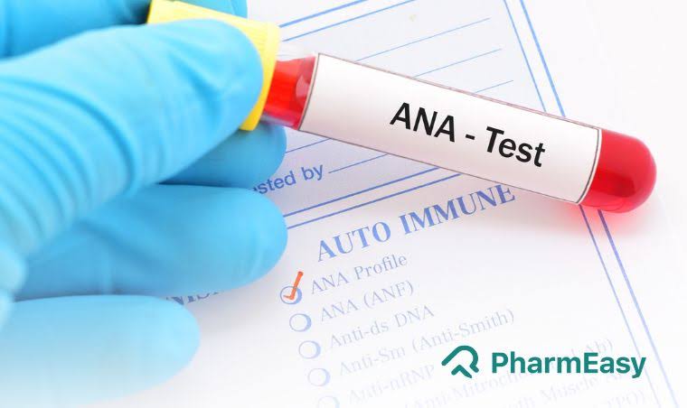 ANA ELISA product image