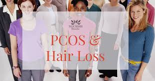 Does Pcos Cause Hair Loss Pcos Hair Loss Hair Regrowth Women Hair Loss Women