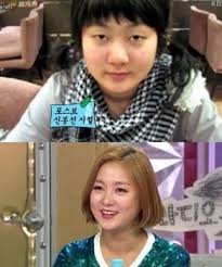 박나래 측도 25일 논란에 대해서 사과하고 하차를 결정했다. ë°•ë‚˜ëž˜ ì„±í˜•ì „ ì–´ë–¨ê¹Œ