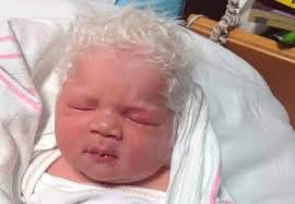 Taglio bimbo corto capelli castani. Bimbo Nasce Con I Capelli Bianchi I Genitori Rimangono Scioccati Dalle Parole Dei Medici Capellistyle