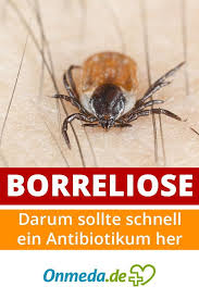 Borreliose Symptome Und Behandlung Der Zeckenbiss Infektion Erkrankungen Krankheit Und Gesundheit Und Wohlbefinden