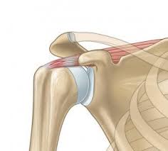 Treatment depends on which tendon you ruptured and how severe the rupture is. Tendinite De La Coiffe Gena