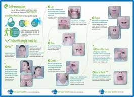 Visit Your Dentist For A Head And Neck Cancer Check – Mouth Cancer  Foundation