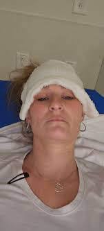 Insurance won't cover low back ablation procedure