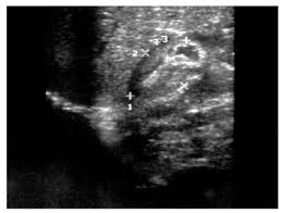 List of sound card standards. Ultrasonographic Scan Of The Hypertrophic Pylorus In A 5 Week Old Male Download Scientific Diagram
