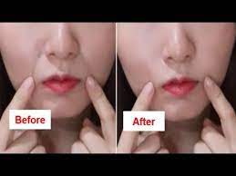 Get rid of smile lines around mouth naturally wrinkles around mouth, laugh lines, or smile lines are an unfortunate part of the aging process. How To Get Rid Of Laugh Lines Nasolabial Folds Naturally At Home Youtube Laugh Lines Nasolabial Folds Anti Aging Beauty Secrets