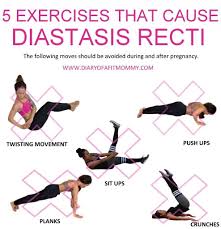 5 Exercises To Avoid That Cause Diastasis Recti Diastasis Recti Exercises Diastasis Recti Diastasis