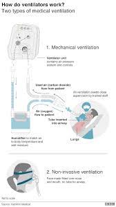 ) deaths recoveries active cases. Covid 19 Shortage Of Ventilators What And How Can You Help To Save Lives Utm Newshub
