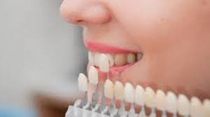 Gigi palsu segera merupakan jenis gigi palsu yang langsung di tempatkan sesaat setelah gigi di ekstraksi. Orange Dental Archives Orange Dental Makeyoufeelbetter