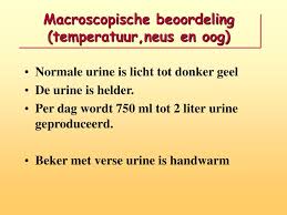 Ppt Urine En Sedimentonderzoek Powerpoint Presentation Free Download Id 362980