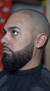 Fully healed SMP “Scalp Micropogmentation”