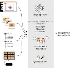 If you aren't sure which type of skin cancer. The Ham10000 Dataset A Large Collection Of Multi Source Dermatoscopic Images Of Common Pigmented Skin Lesions Scientific Data
