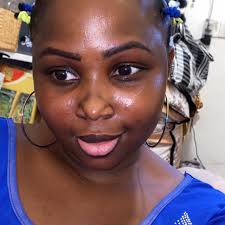 How to reduce lip lines and wrinkles?