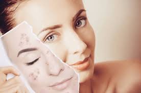 These can be very irritating and cause you pain, especially if you eat the wrong foods. How To Get Rid Of Chicken Pox Scars Kansas City Ipl Bbl Photo Facials Fillers Picosure Laser Facial Premier Vein And Body By Schwartz