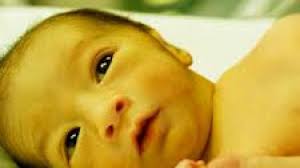 Sel darah merah mengalami penguraian terlalu cepat mengakibatkan kadar bilirubin meningkat pesat. 7 Penyebab Bayi Kuning Baru Lahir Hamil Co Id