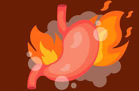 Sodbrennen In Der Schwangerschaft