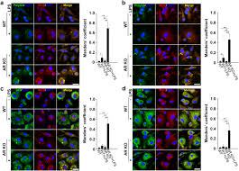 Contact them to learn more about all the corporate financial services that they offer. Aldose Reductase Deficiency Inhibits Lps Induced M1 Response In Macrophages By Activating Autophagy Cell Bioscience Full Text