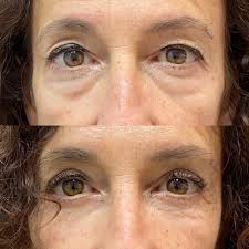 Clinica Estética y Cirugía Oculoplástica Ceomedica