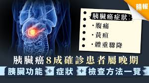 1 day ago · 根據 台灣癌症基金會 指出，胰臟位於後腹膜腔，早期胰臟癌沒有什麼症狀，若隨著腫瘤逐漸擴大，就會出現上腹痛、背痛、黃疸、體重減輕及下痢症狀。 ç™Œä¸­ä¹‹çŽ‹ èƒ°è‡Ÿç™Œ8æˆç¢ºè¨ºæ‚£è€…å±¬æ™šæœŸèƒ°è‡ŸåŠŸèƒ½ ç—‡ç‹€ æª¢æŸ¥æ–¹æ³•ä¸€è¦½ æ™´å ± å¥åº· è…«ç˜¤åŠç™Œç—‡ D201030