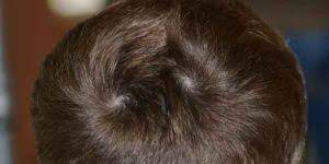 images?q=tbn:ANd9GcTH2SseBfE5gvOLF-KQhy8