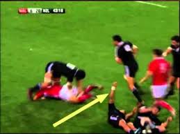 Example Of Tonic Posturing Following Concussion Youtube