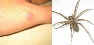 Pin On Home Remedies