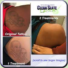 Black and red tattoos do quite well. Clean Slate Laser On Twitter We Often Get Asked About The Safety And Effectiveness Of Tattoo Removal On Medium Or Dark Skin Our Unique Approach Has Given Us A Long Track Record